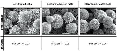 The Repurposing of Anti-Psychotic Drugs, <mark class="highlighted">Quetiapine</mark> and Olanzapine, as Anti-Cryptococcus Drugs